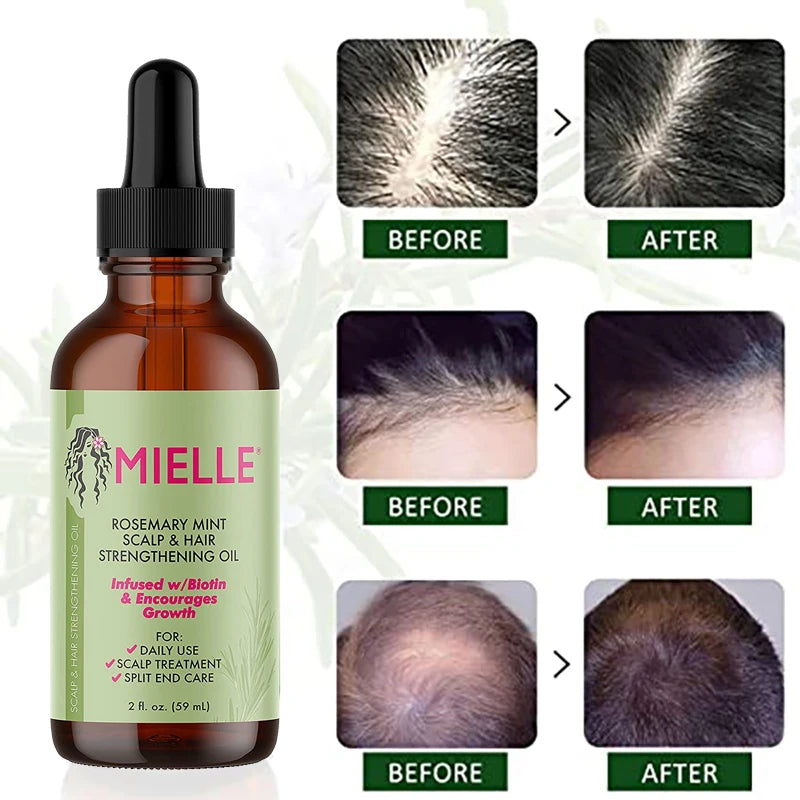 Hair Growth Essential Oil Rosemary Mint MIELLE